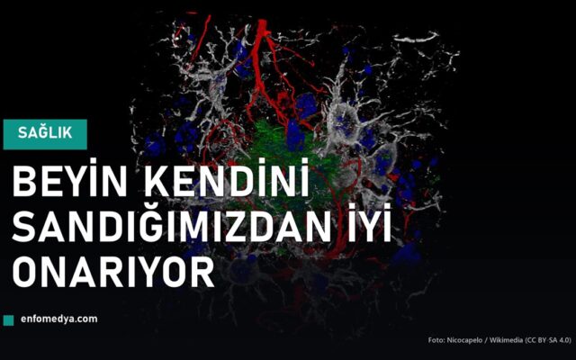 Beyindeki yıldız biçimli astrosit hücrelerinin mikroskop görüntüsü